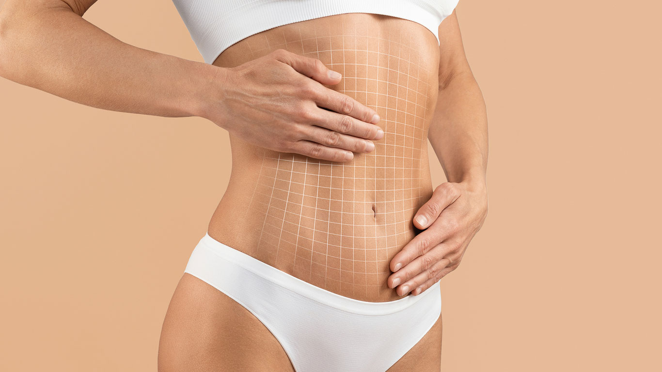 What Helps Tightness After a Tummy Tuck?