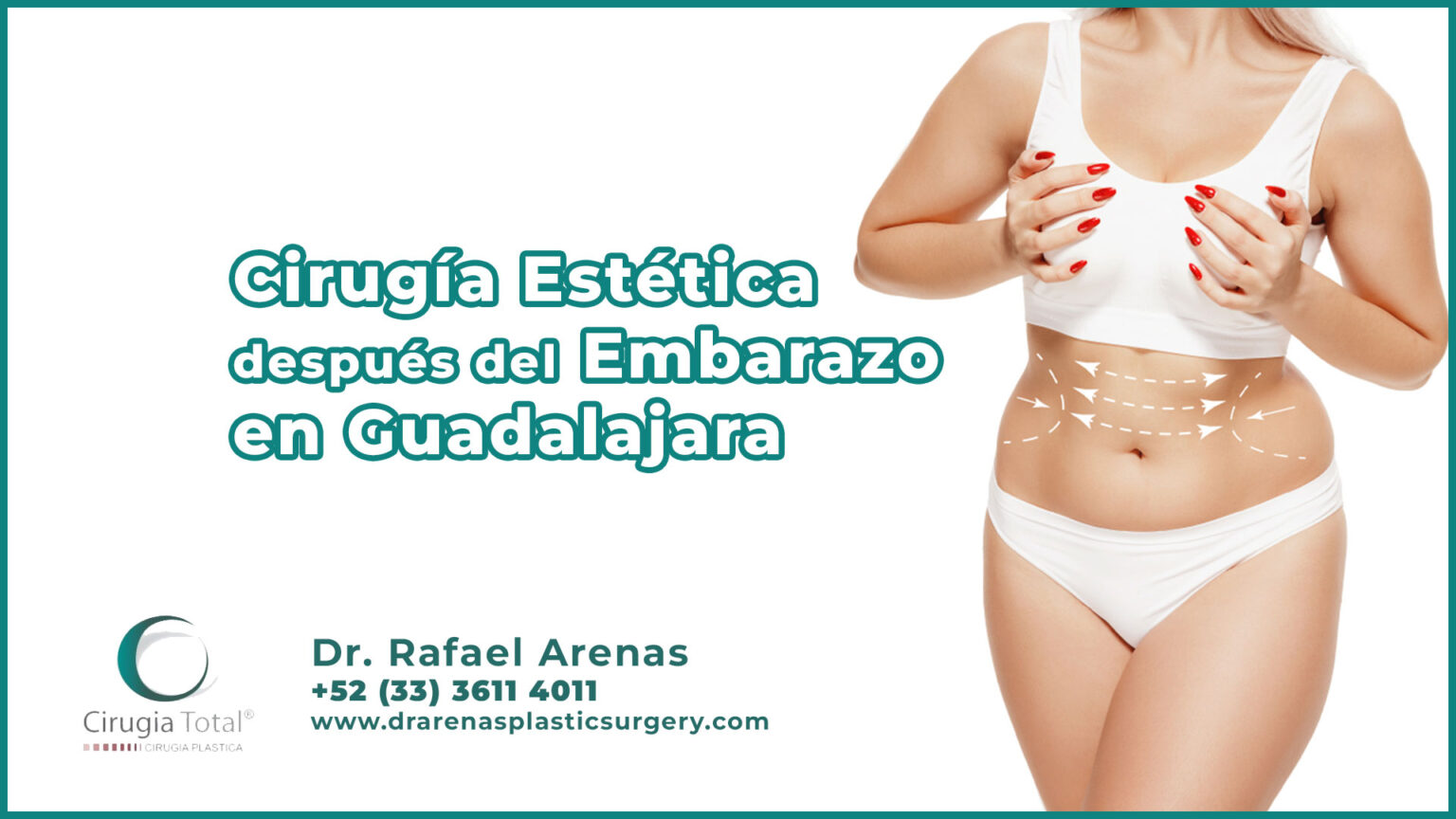 Cirugía Estética después del Embarazo en Guadalajara