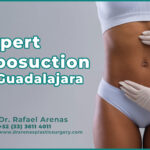 Expert Liposuction in Guadalajara