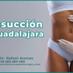 Liposucción en Guadalajara