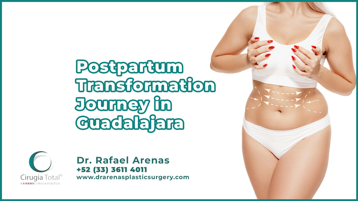 Postpartum Transformation Journey in Guadalajara